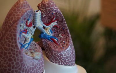 Risk of Deadly Lung Disease Linked to Popular Kitchen Countertops