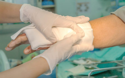 How a Lawsuit Can Help You With Your Burn Injury